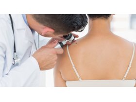 Sutra besplatna dermoskopija u šimanovačkoj ambulanti